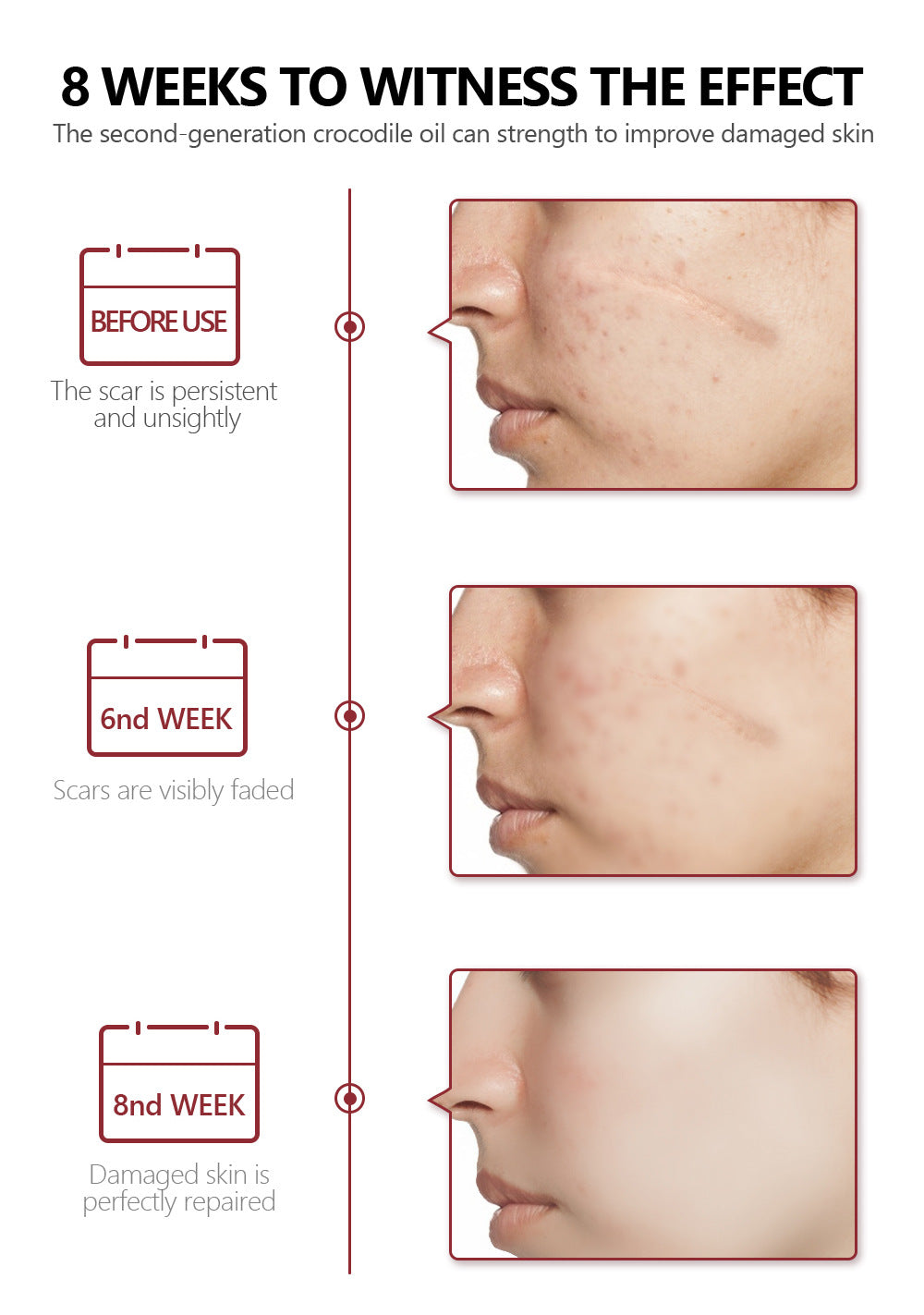 Sérum para Eliminar Manchas Faciales y Cicatrices | Tratamiento Reparador de Piel | Remoción de Cicatrices de Acné y Queloides