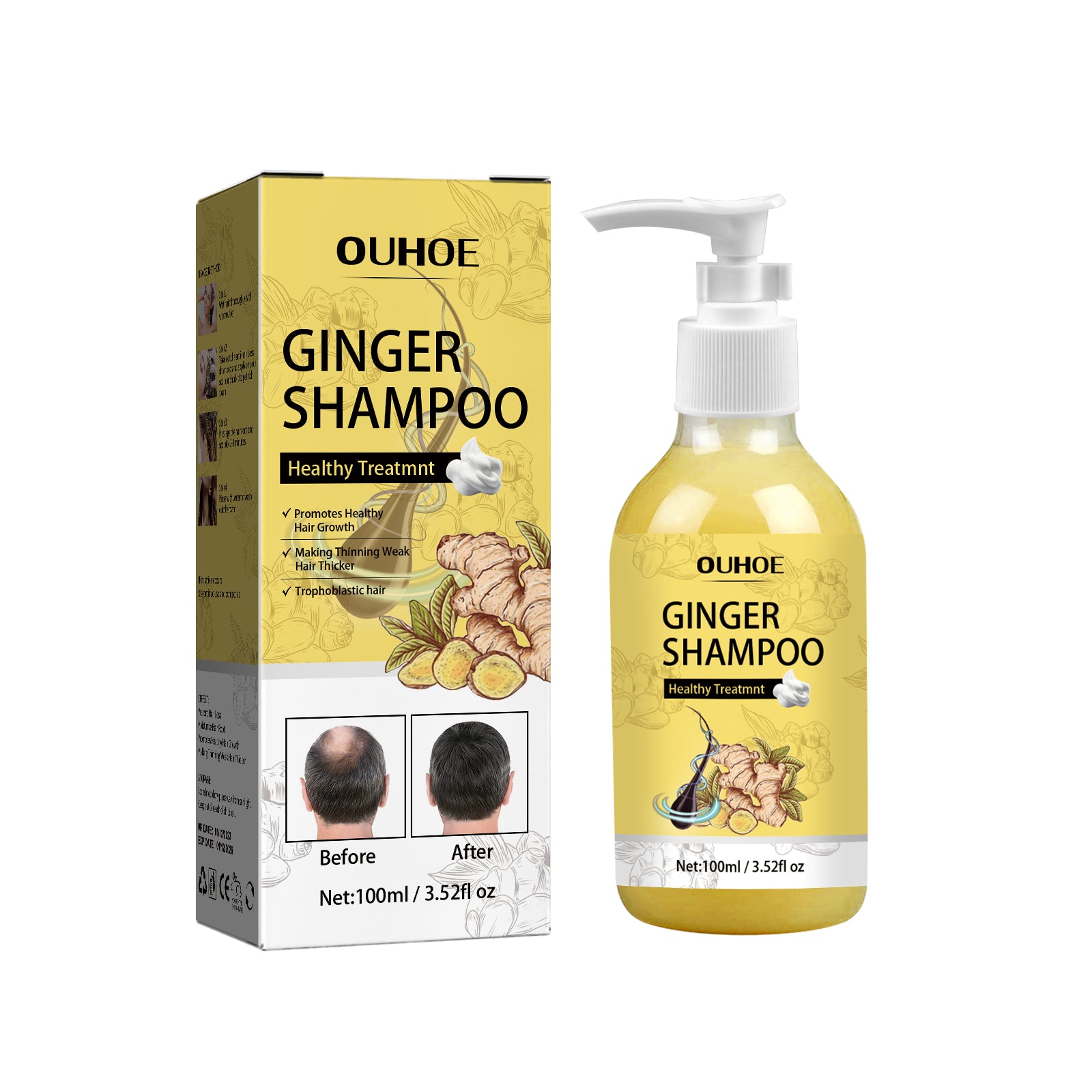 Champú de Jengibre para Cabello Denso – Hidrata, Alivia la Picazón y Fortalece