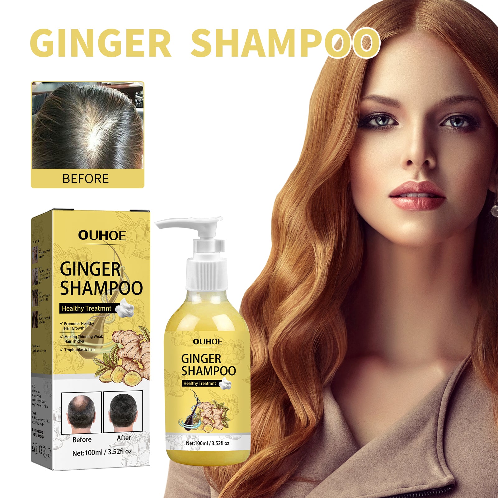 Ingwer-Shampoo für dickes Haar – spendet Feuchtigkeit, lindert Juckreiz und stärkt
